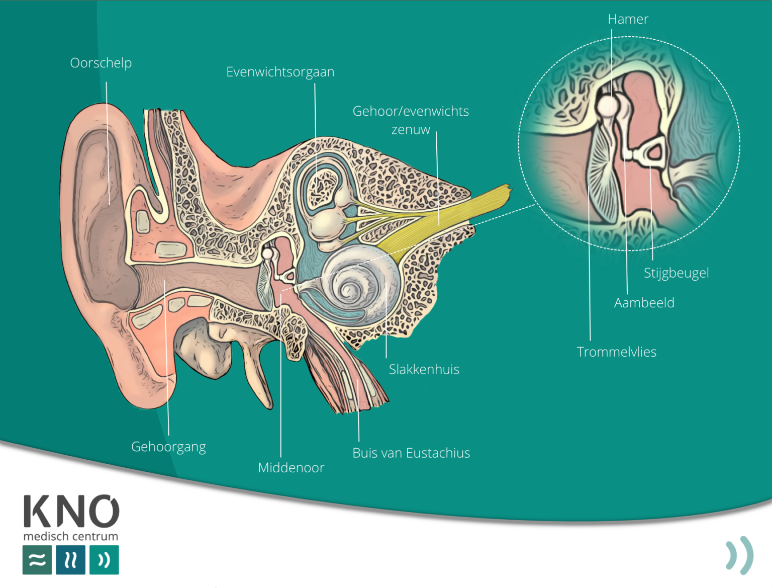 plotsdoofheid (sudden deafness) - KNO MEDISCH CENTRUM