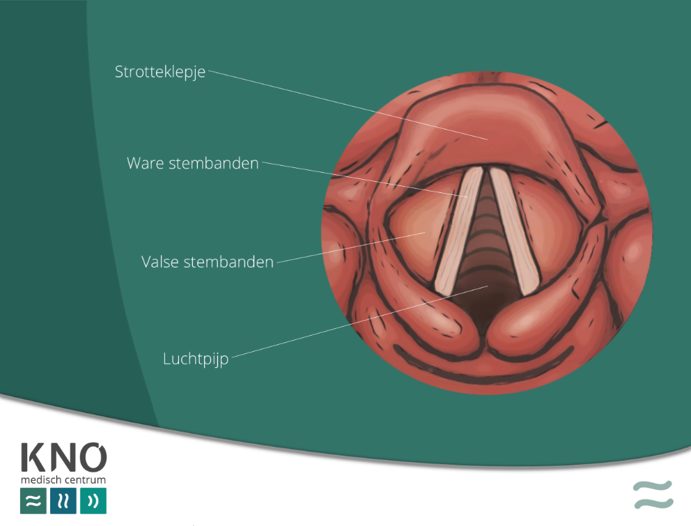 Schorre stem