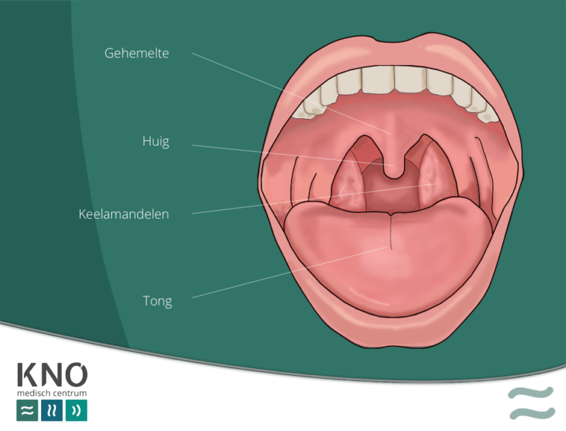 droge keel met klachten - KNO MEDISCH CENTRUM